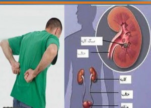 نارسایی مزمن کلیه در کمین مبتلایان به دیابت و فشار خون